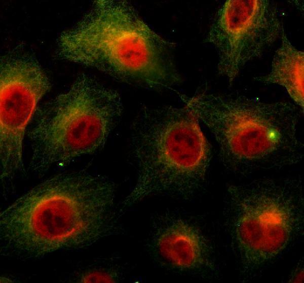 a10811 1 exosc1 primary antibodies if testing 1