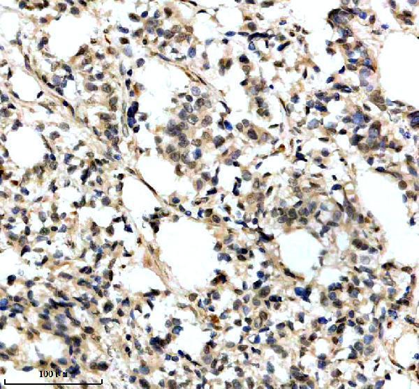 a10811 1 exosc1 primary antibodies ihc testing 1