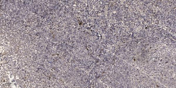 a10813 1 adpgk primary antibodies ihc testing 1