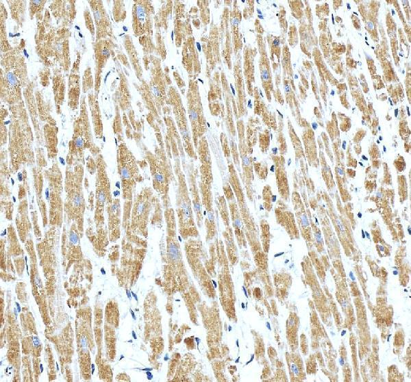 IHC analysis of NDUFA7 using anti-NDUFA7 antibody (A10817-1)