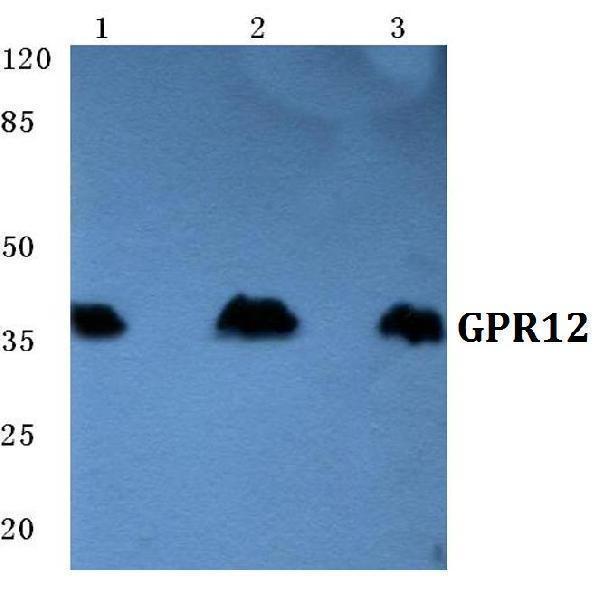 a10818 1 gpr12 primary antiboties wb testing 1