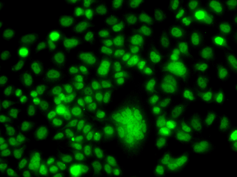 a10836 ppan primary antiboties if testing 4