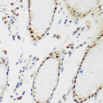a10836 ppan primary antiboties ihc testing 3