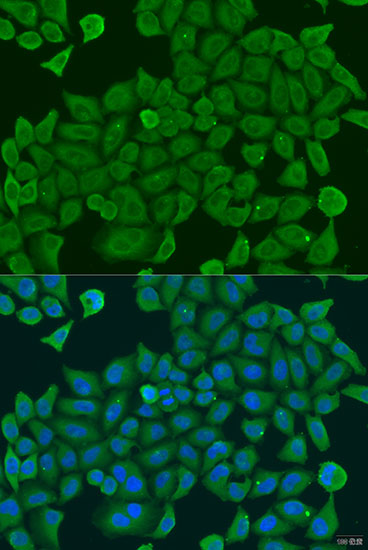 a10841 shc4 primary antiboties if testing 1