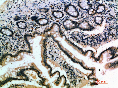 a10846 1 il17b primary antibodies ihc testing 1