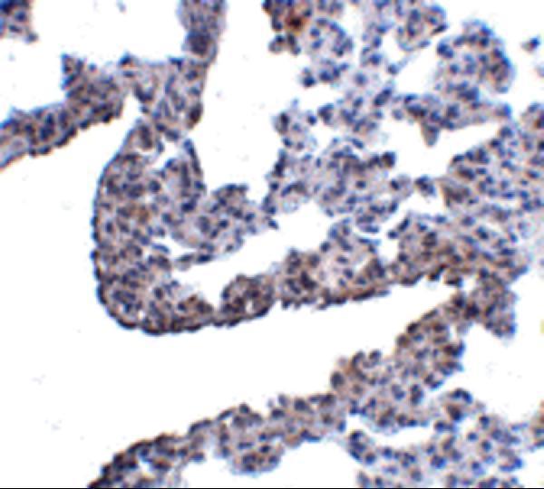 a10847 pcdh12 primary antibodies ihc testing 2
