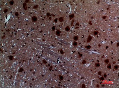 a10853 layn primary antibodyes ihc testing 3