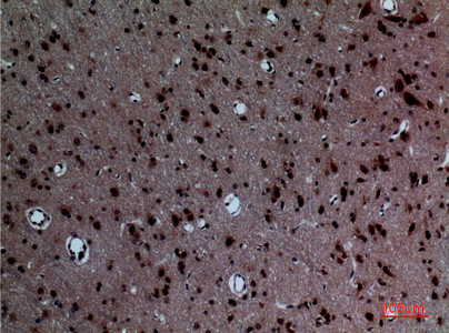 a10853 layn primary antibodyes ihc testing 4