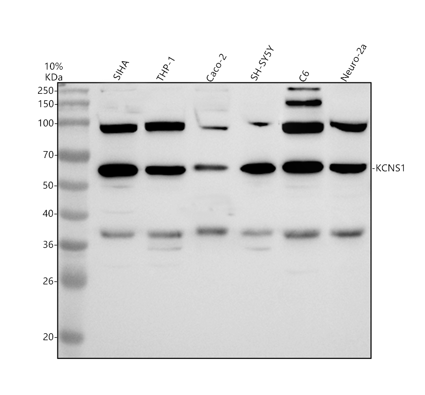 Western blot analysis of KCNS1 using anti-KCNS1 antibody (A10856-2)