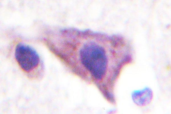 a10858 2 kcnj16 primary antiboties ihc testing 2