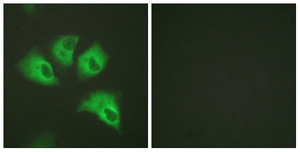 a10858s416 kcnj16 primary antibodies if testing 4