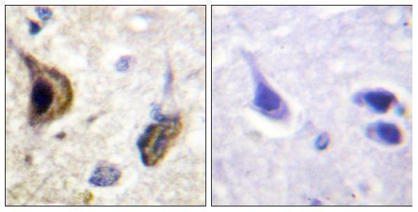 a10858s416 kcnj16 primary antibodies ihc testing 3