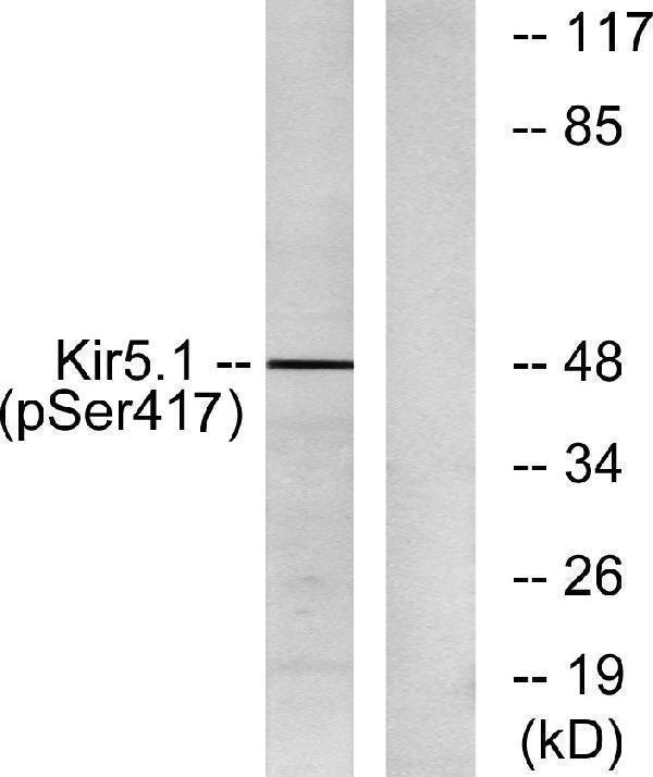 a10858s416 kcnj16 primary antibodies wb testing 2