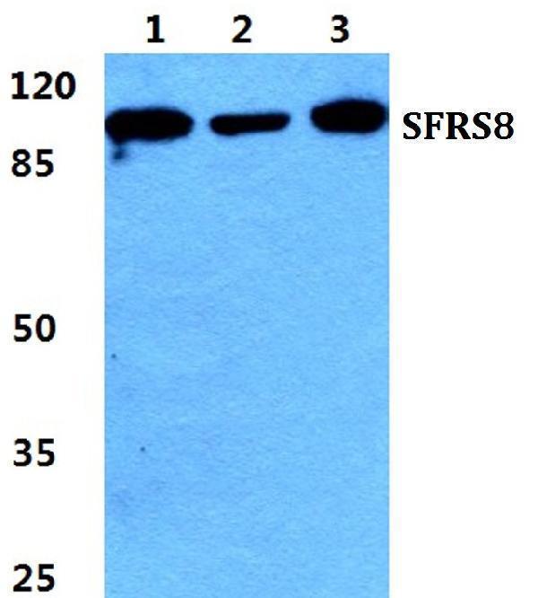 a10863 1 sfswap primary antiboties wb testing 1