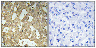 a10869 1 rabep2 primary antibodies ihc testing 1