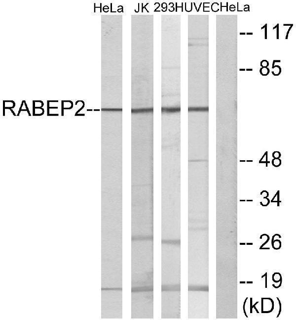 Western blot analysis of lysates from HeLa, Jurkat, 293, and HUVEC cells, using RABEP2 Antibody