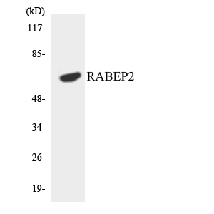 Western blot analysis of the lysates from HeLa cells using RABEP2 antibody