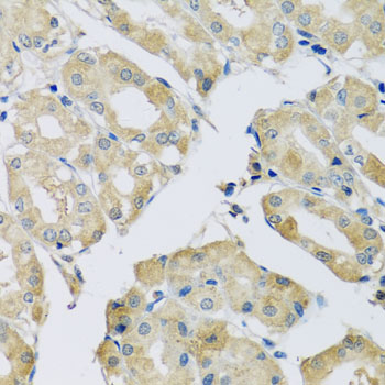 Immunohistochemistry of paraffin-embedded mouse lung using ABCF2 antibody at dilution of 1:100 (x40 lens)
