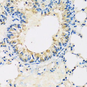 Immunohistochemistry of paraffin-embedded human stomach using ABCF2 antibody at dilution of 1:100 (x40 lens)