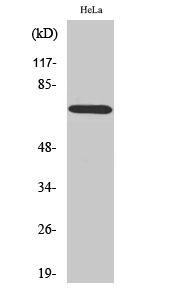 Western Blot analysis of HeLa cells using ABCF2 Polyclonal Antibody