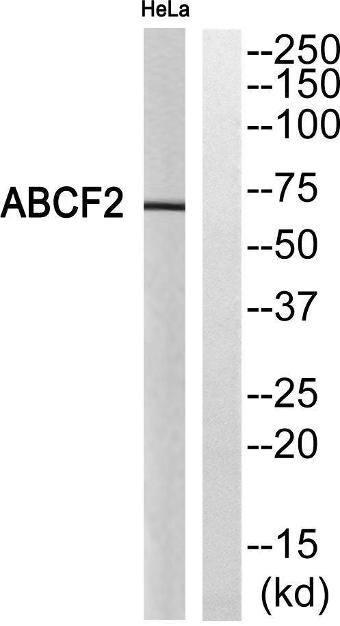 Western blot analysis of ABCF2 Antibody