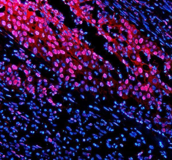IF analysis of TNFAIP2 using anti-TNFAIP2 antibody (A10874-2)