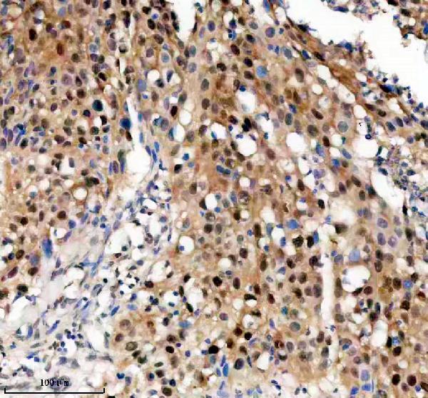 IHC analysis of TNFAIP2 using anti-TNFAIP2 antibody (A10874-2)