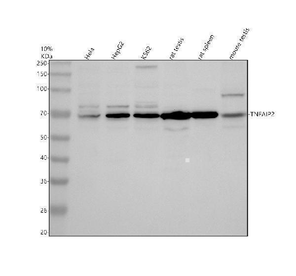 Western blot analysis of TNFAIP2 using anti-TNFAIP2 antibody (A10874-2)
