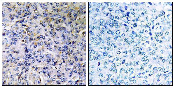 a10875 1 acad11 primary antibodies ihc testing 1