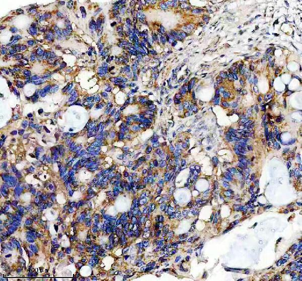 IHC analysis of EEF1G using anti-EEF1G antibody (A10881-1)