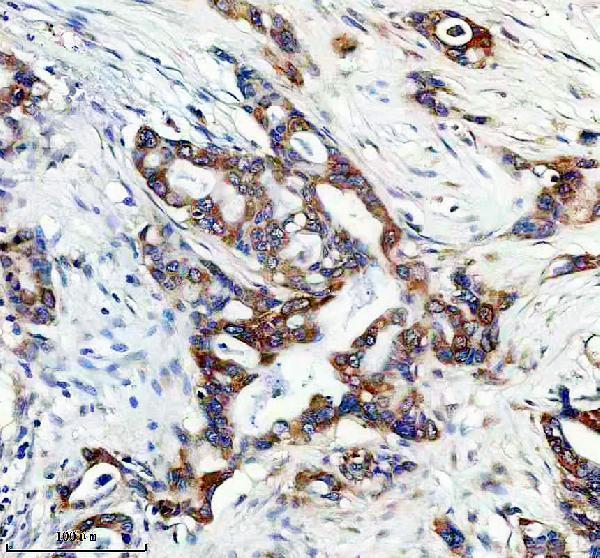 IHC analysis of EEF1G using anti-EEF1G antibody (A10881-1)