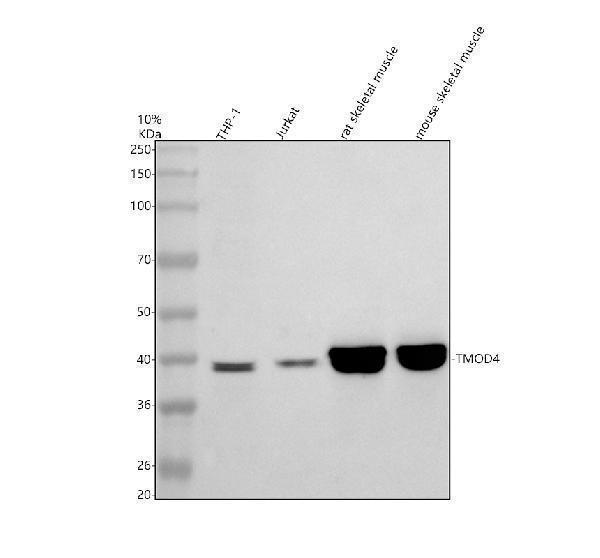 Western blot analysis of TMOD4 using anti-TMOD4 antibody (A10885-1)