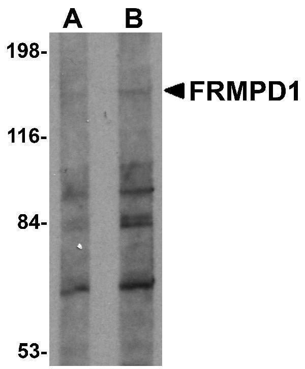 a10887 frmpd1 primary antibodies wb testing 1