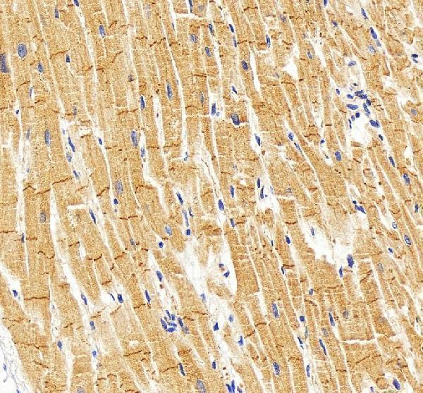 IHC analysis of Cadherin-15/CDH15 using anti-Cadherin-15/CDH15 antibody (A10888-1)