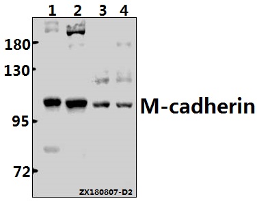 Western blot (WB) analysis of M-cadherin (A108) Antibody at 1:500 dilution
Lane1:MG63 whole cell lysate(30ug)
Lane2:U-87MG whole cell lysate(40ug)
Lane3:The Brain tissue lysate of Mouse(40ug)
Lane4:The Brain tissue lysate of Rat(40ug)