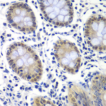 a10896 gtf2f2 primary antiboties ihc testing 2