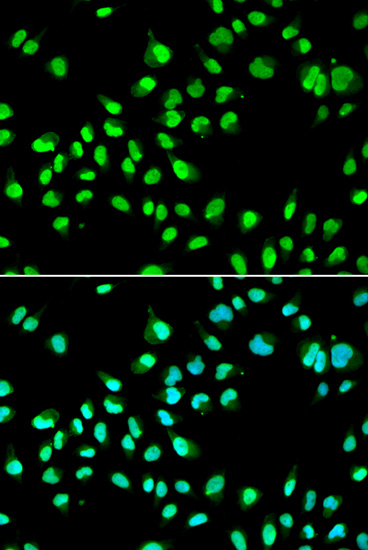 a10896 gtf2f2 primary antiboties ihc testing 3