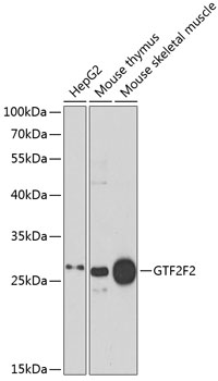 a10896 gtf2f2 primary antiboties wb testing 1
