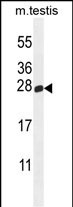 a10904 anti pld6 antibody center wb testing 1