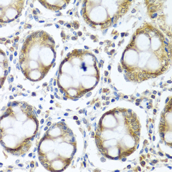 Immunohistochemistry of paraffin-embedded human colon using IFI44 antibody  at dilution of 1:100 