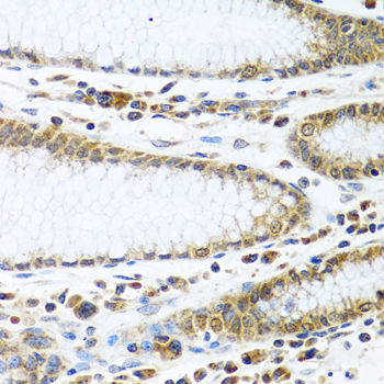 Immunohistochemistry of paraffin-embedded human stomach using IFI44 antibody  at dilution of 1:100 