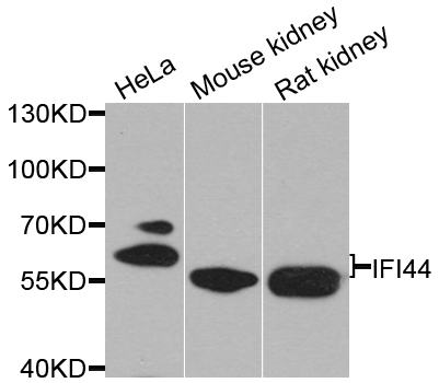 Western blot analysis of extracts of various cell lines, using IFI44   antibody  at 1:1000 dilution
