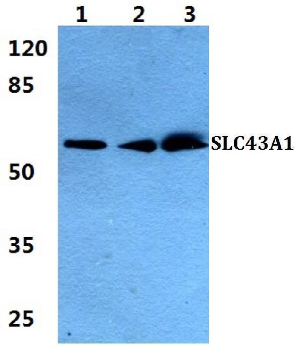 Western blot (WB) analysis of SLC43A1 polyclonal antibody at 1:500 dilution
Lane1:HEK293T cell lysate
Lane2:sp2/0 cell lysate
Lane3:H9C2 cell lysate