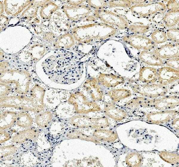 a10921 1 lclat1 primary antibodies ihc testing 1