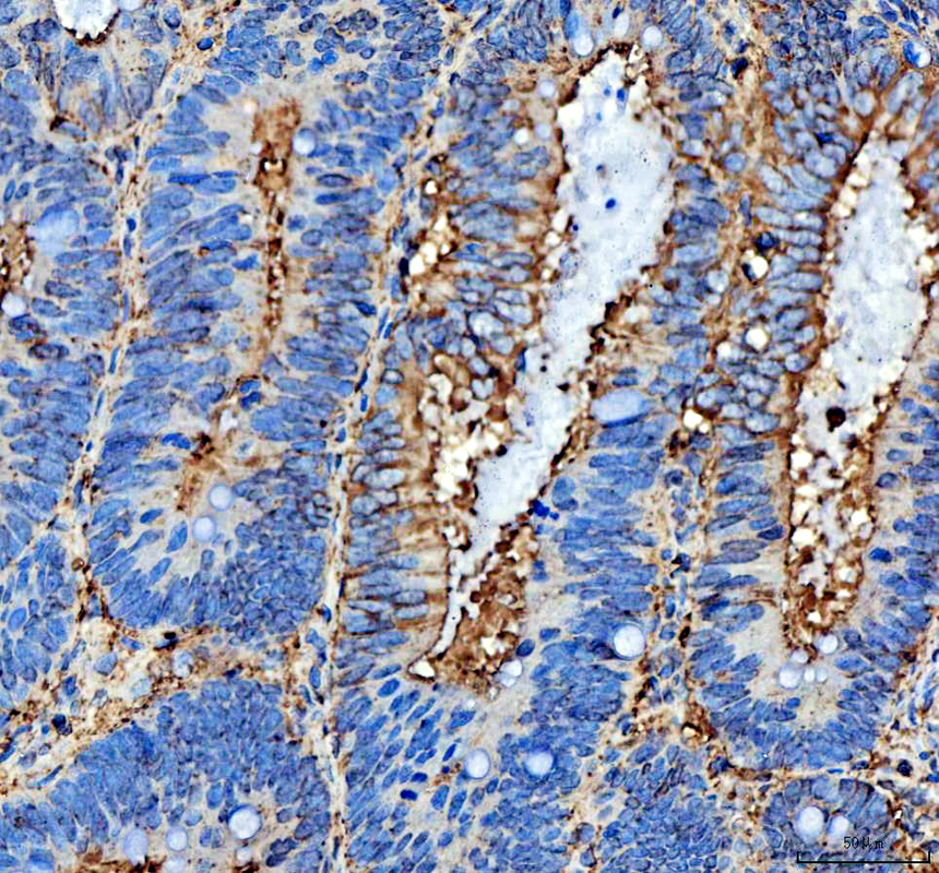 IHC analysis of NME6 using anti-NME6 antibody (A10922-1)