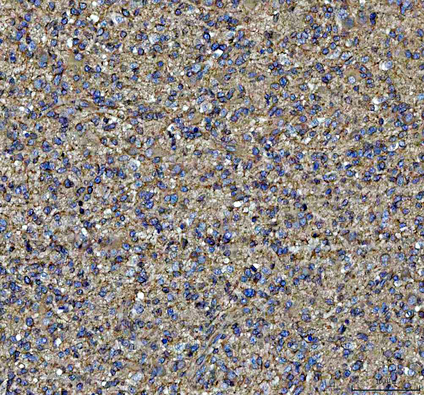 IHC analysis of NME6 using anti-NME6 antibody (A10922-1)