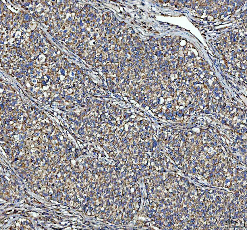 a10922 1 nme6 primary antibodies ihc testing 3