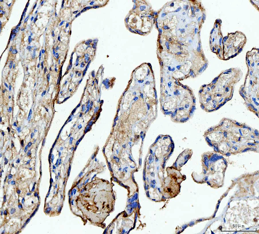 a10922 1 nme6 primary antibodies ihc testing 4