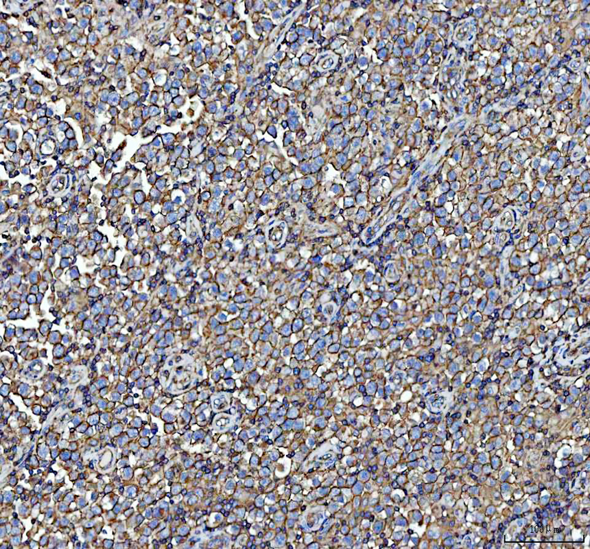 a10922 1 nme6 primary antibodies ihc testing 5