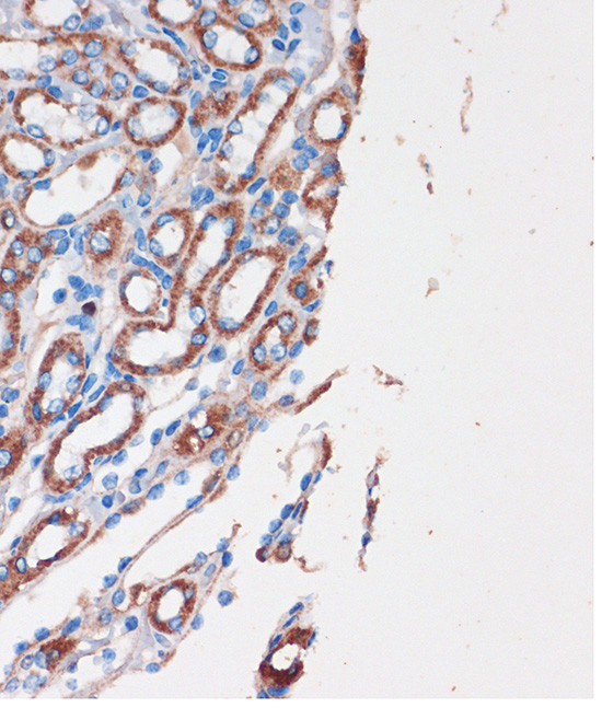 Immunohistochemistry of paraffin-embedded Mouse kidney using CHDH Rabbit pAb  at dilution of 1:100 